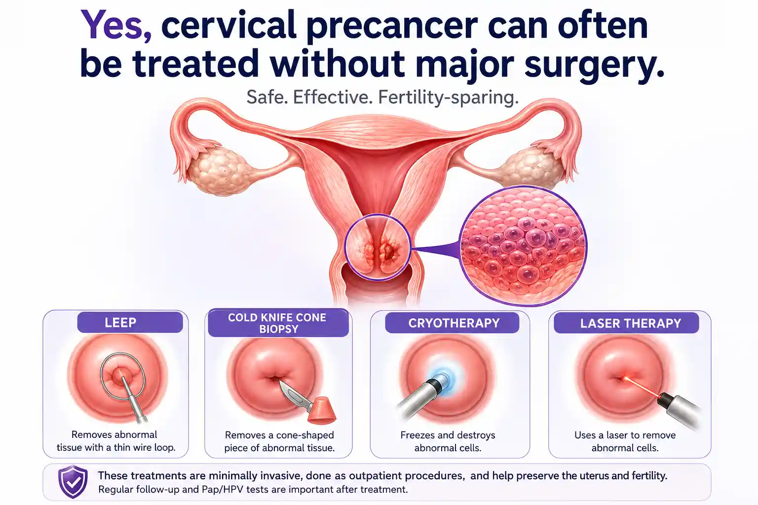 Cervical Precancer Treatment
